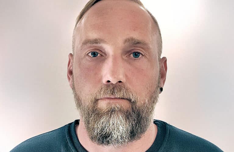 Matthias-nachher