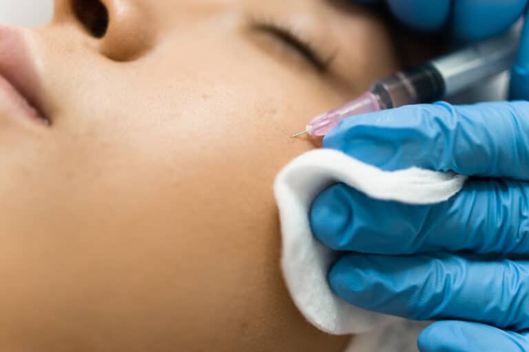 young-woman-receiving-beauty-injection-on-her-face-2024-10-18-21-15-59-utc