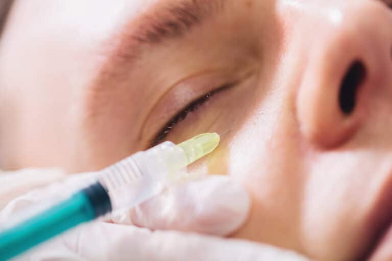 injectable-tissue-stimulator-on-man-face-in-beauty-2025-04-01-22-45-06-utc