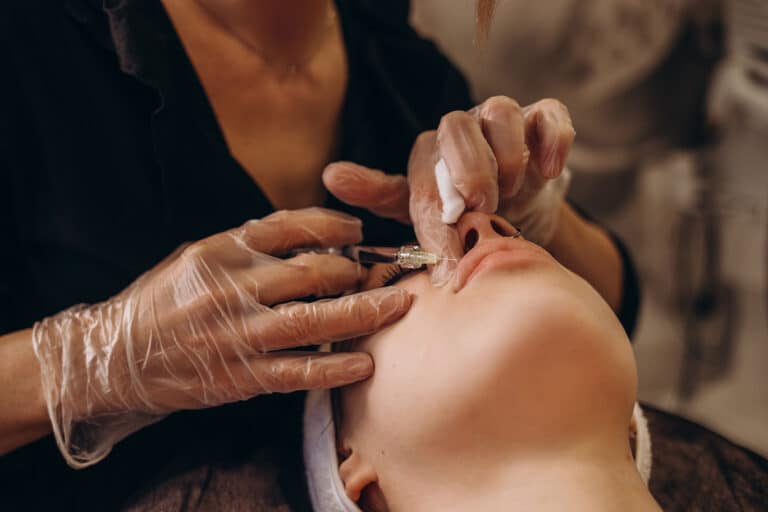 injections-of-the-lips-correction-form-the-upper-2025-04-02-22-46-23-utc