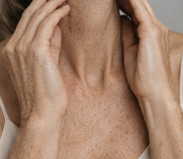 Decollete-Bereich vor Faltenbehandlung