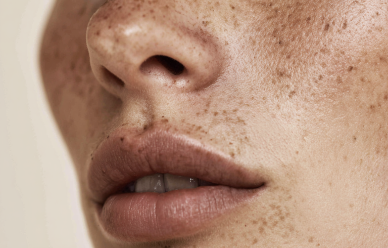 Nahaufnahme Lippenbehandlung mit Hyaluron